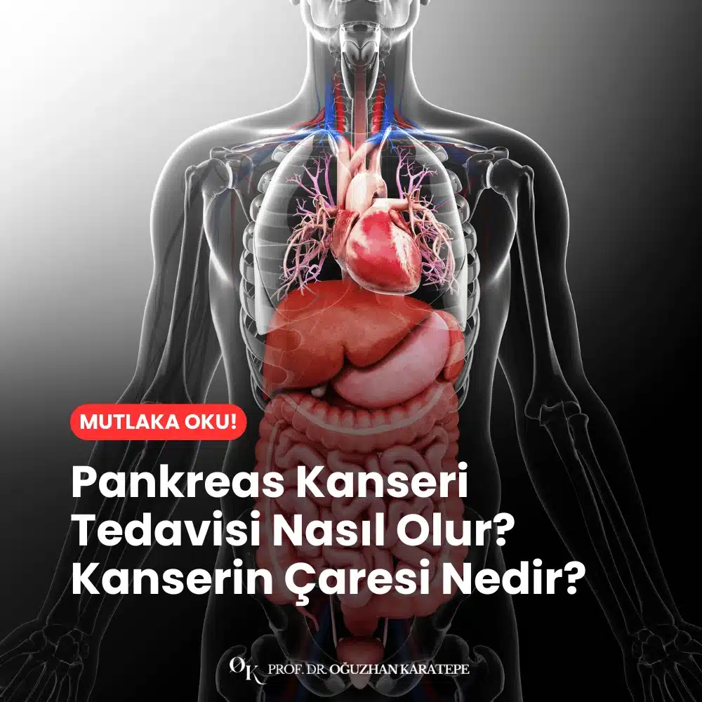 Pankreas Kanseri Tedavisi Nasıl Olur? Kanserin Çaresi Nedir?