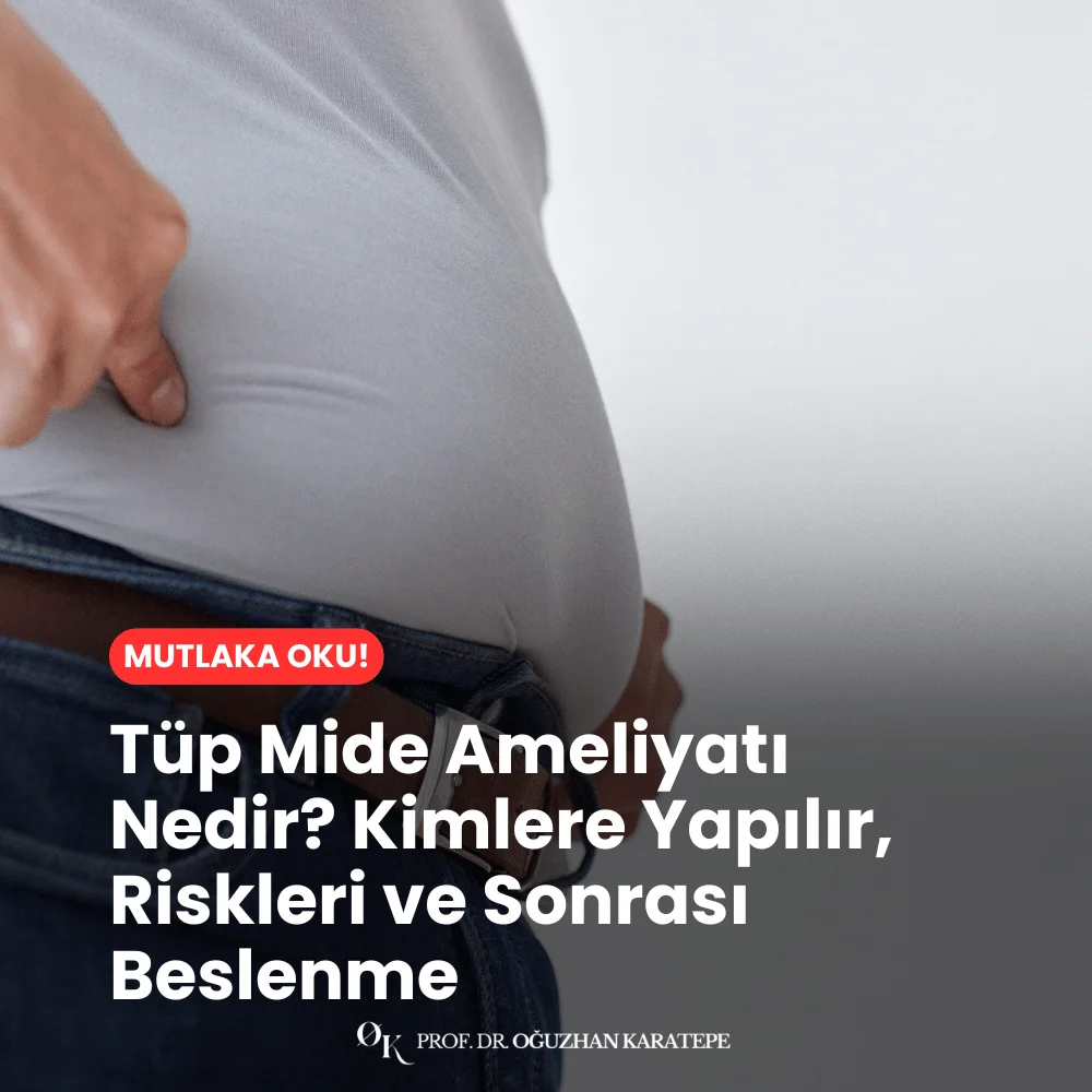 Tüp Mide Ameliyatı Nedir? Kimlere Yapılır, Riskleri ve Sonrası Beslenme Nedir