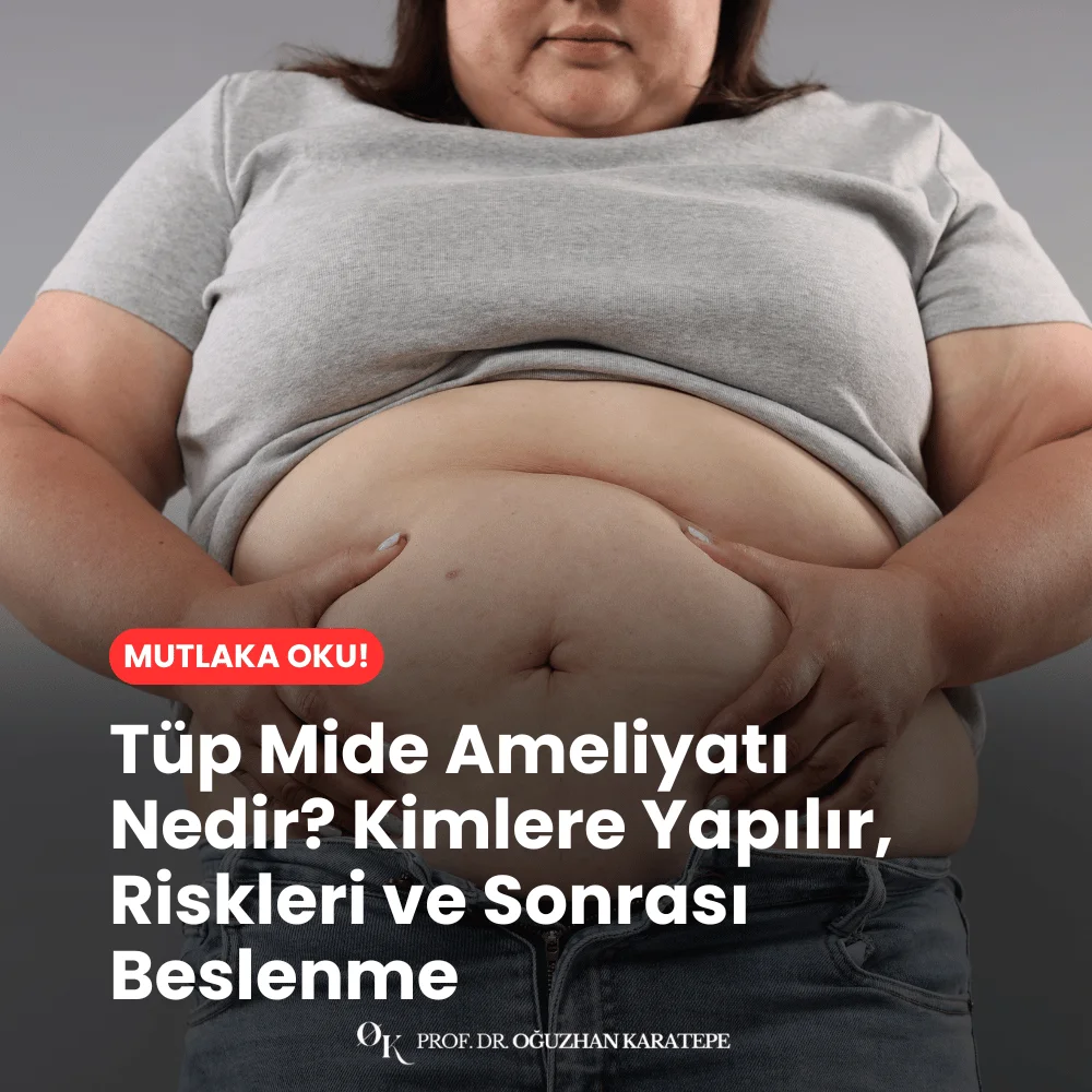 Tüp Mide Ameliyatı Nedir? Kimlere Yapılır, Riskleri ve Sonrası Beslenme