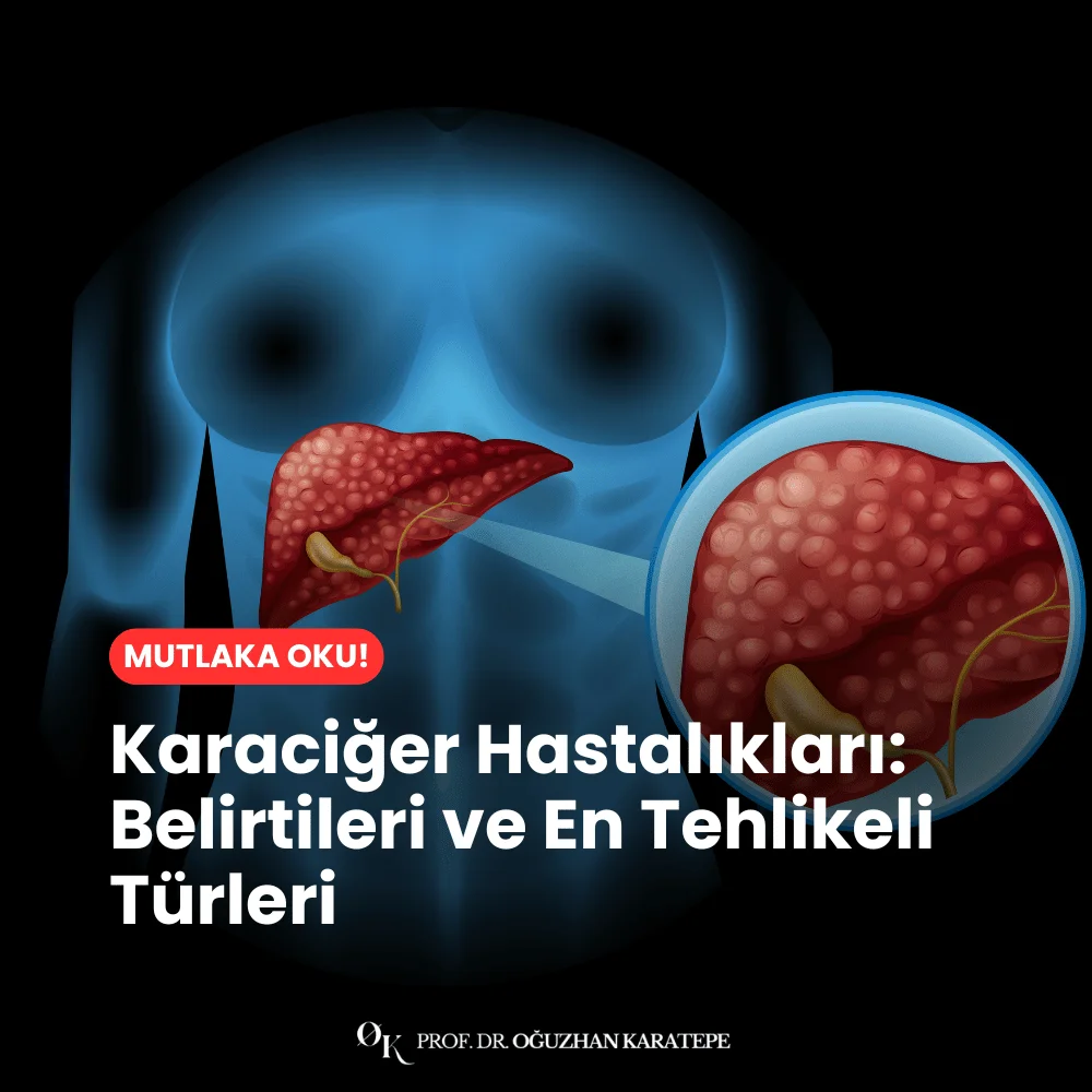Karaciğer Hastalıkları Belirtileri ve En Tehlikeli Türleri