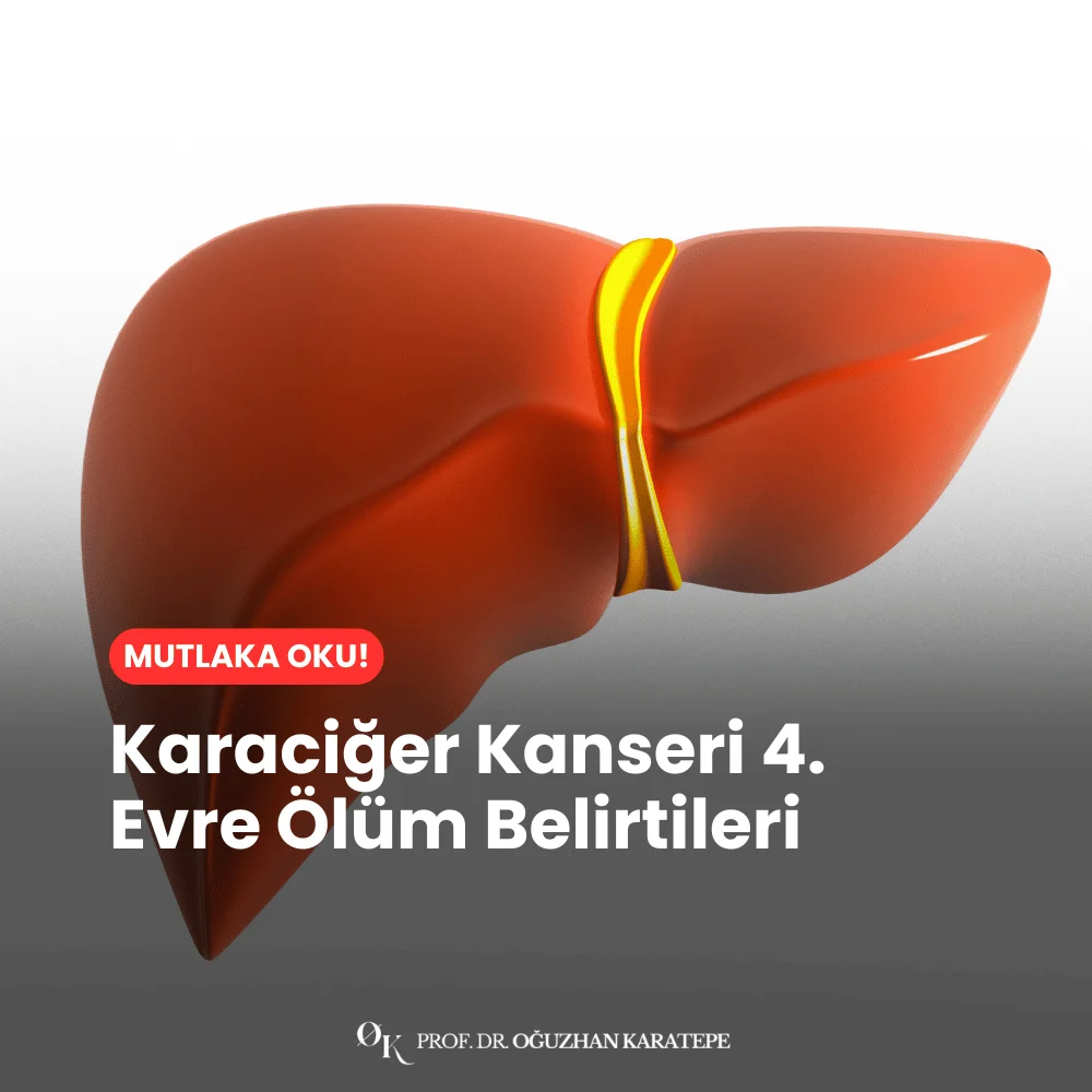 Karaciğer Kanseri 4. Evre Ölüm Belirtileri nedir