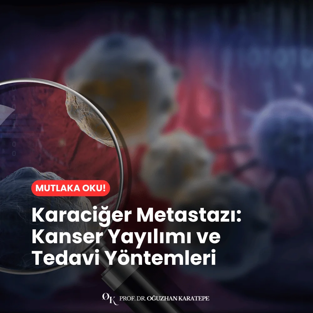Karaciğer Metastazı Kanser Yayılımı ve Tedavi Yöntemleri nedir