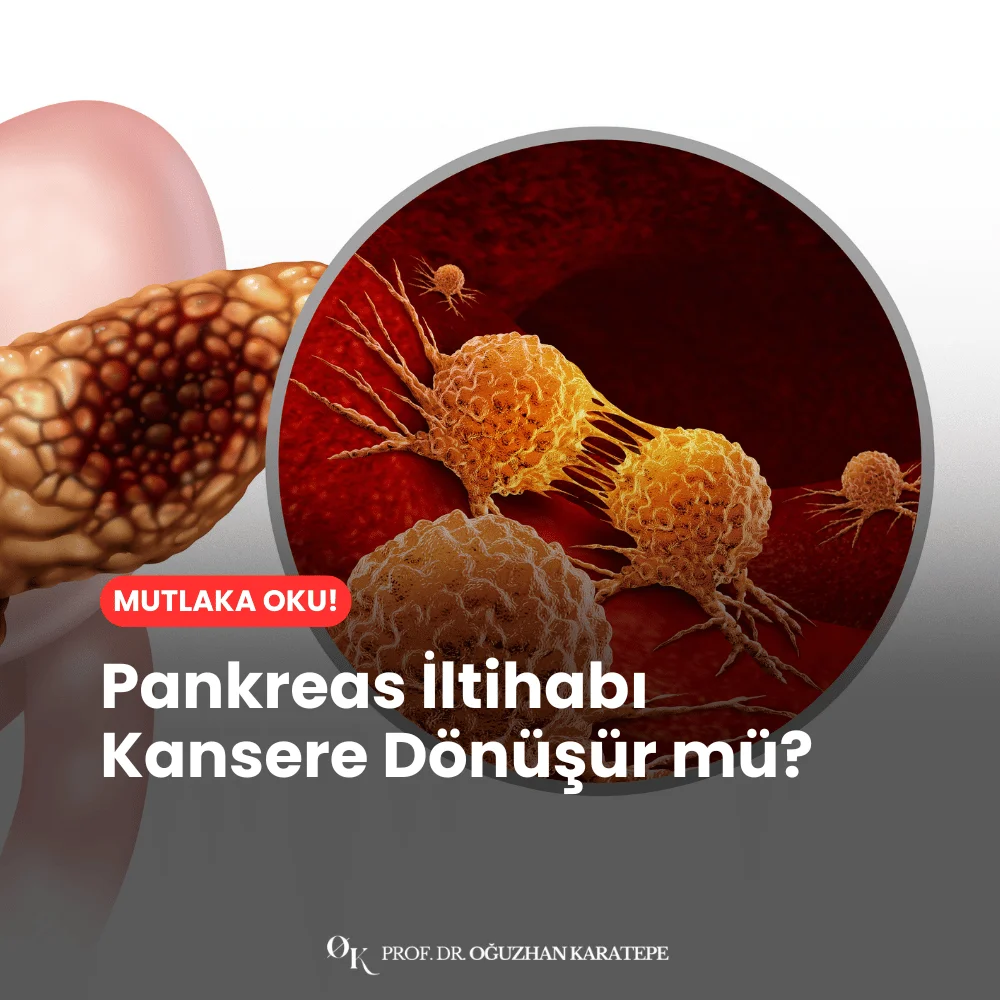 Pankreas İltihabı Kansere Dönüşür mü