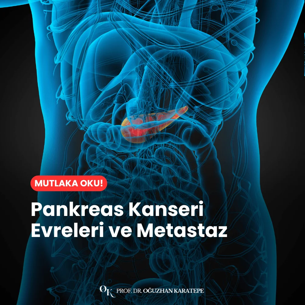 Pankreas Kanseri Evreleri ve Metastaz