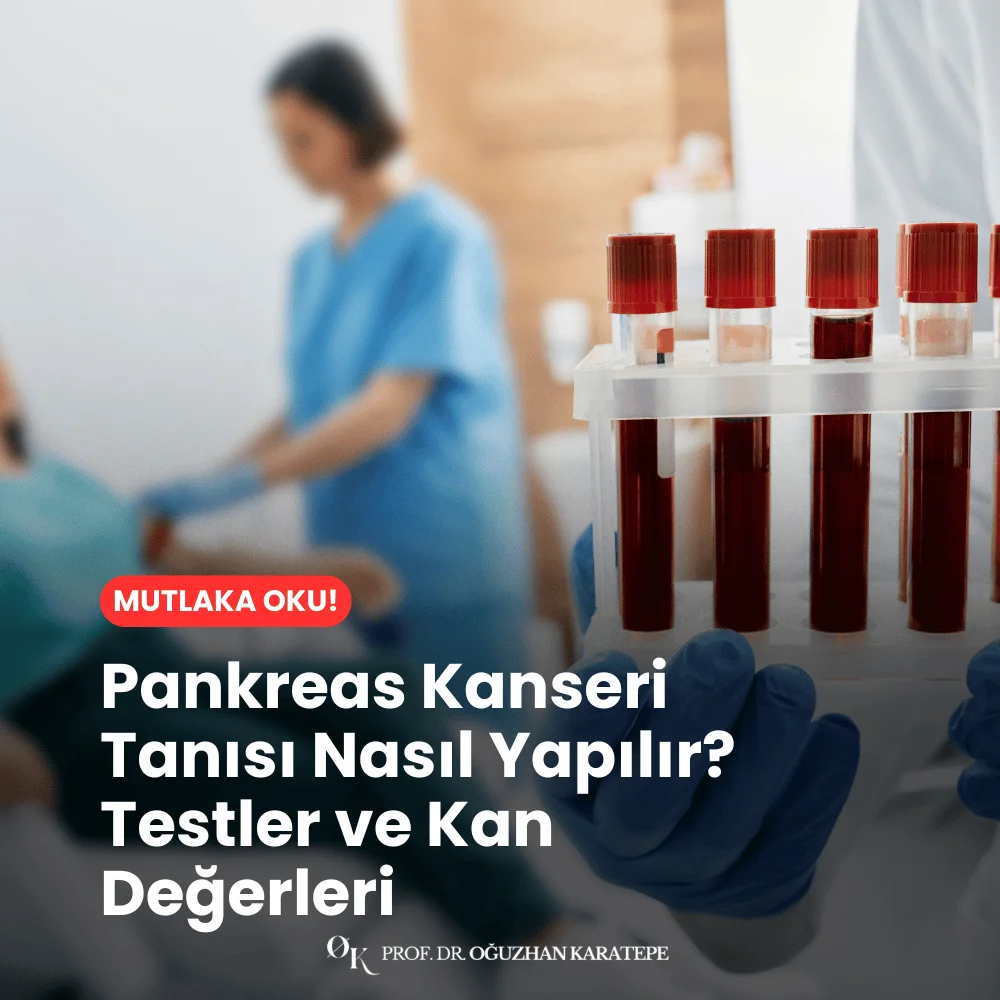 Pankreas Kanseri Tanısı Nasıl Yapılır? Testler ve Kan Değerleri