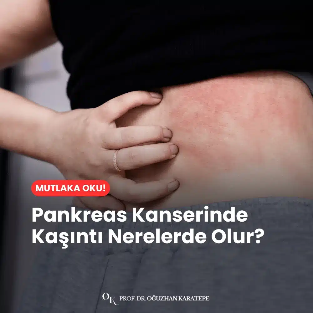Belirtiler, Etkilenen Bölgeler ve Dikkat Edilmesi Gerekenler