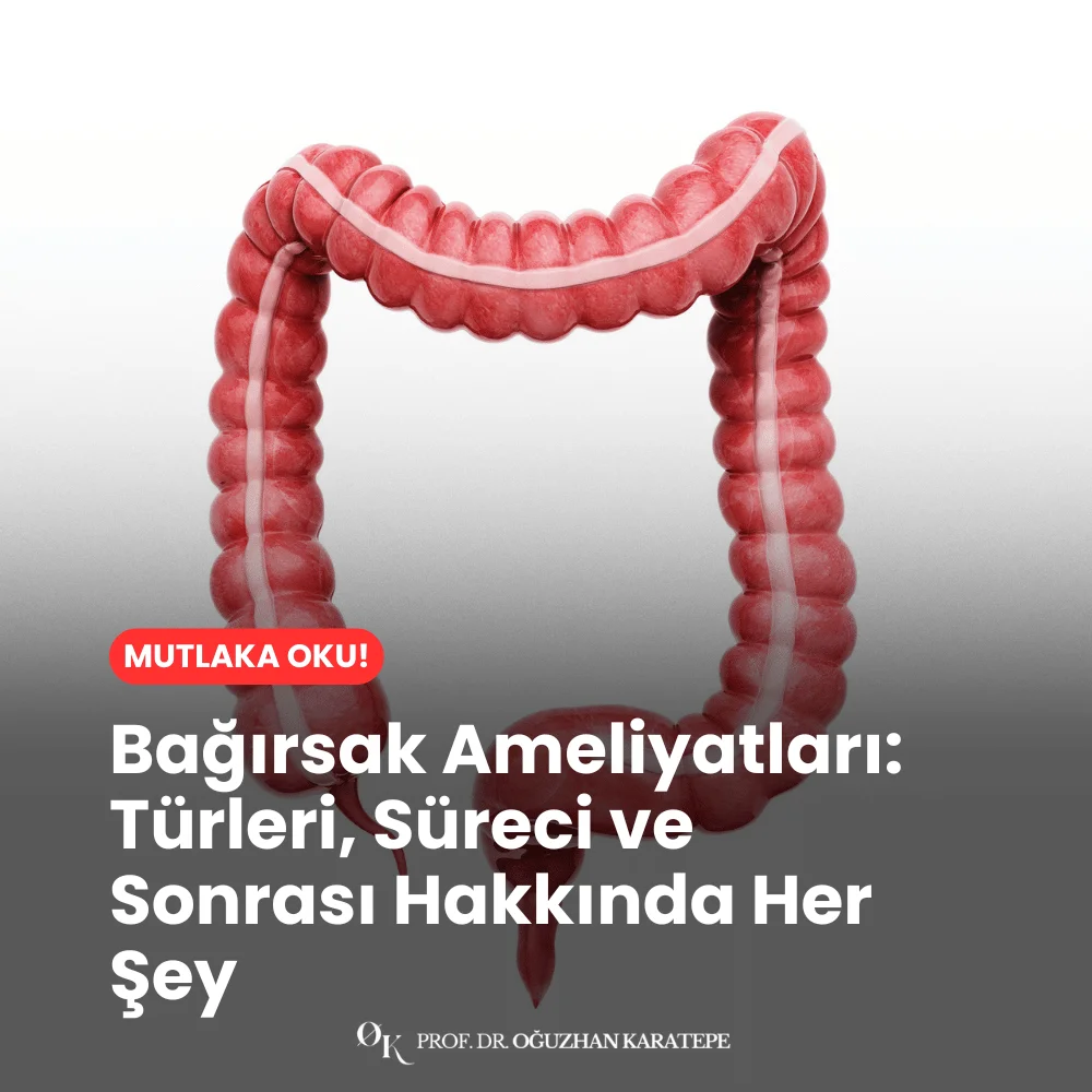 Bağırsak Ameliyatları Türleri, Süreci ve Sonrası Hakkında Her Şey Güncel