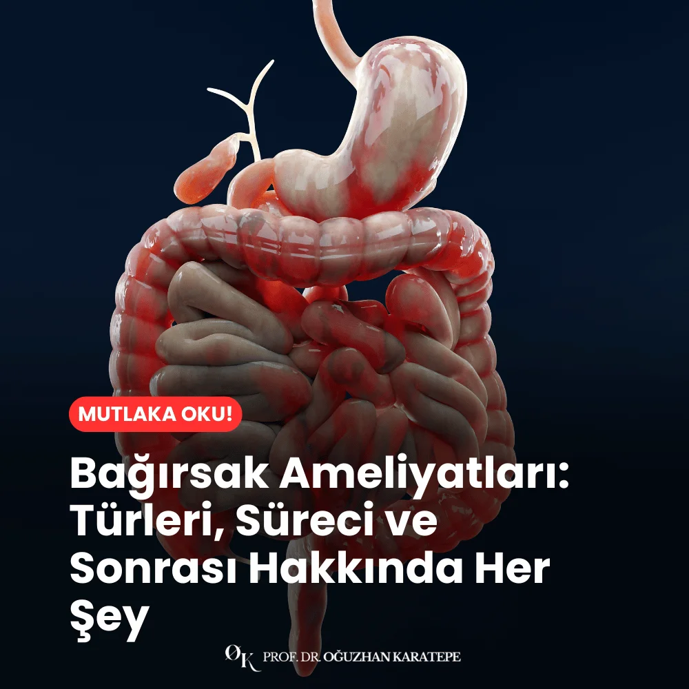 Bağırsak Ameliyatları Türleri, Süreci ve Sonrası Hakkında Her Şey