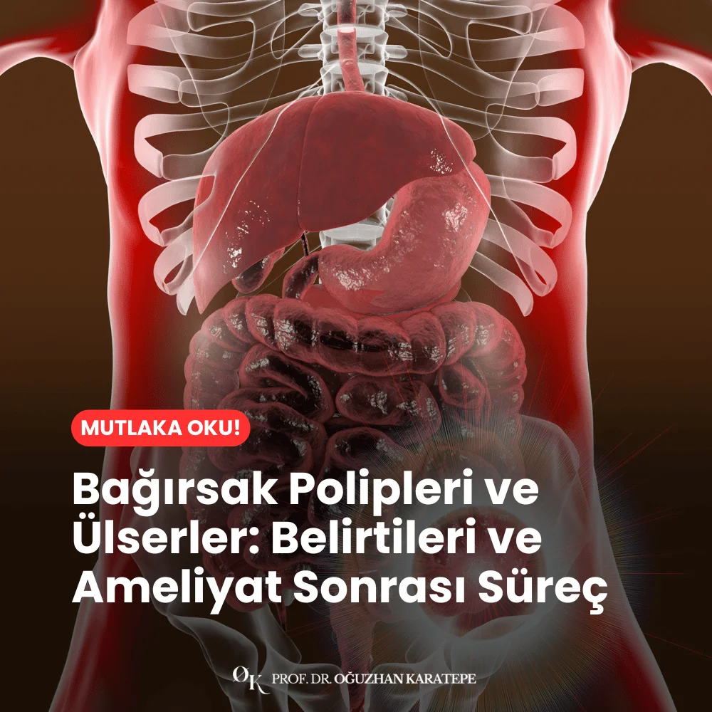 Bağırsak Polipleri ve Ülserler Belirtileri ve Ameliyat Sonrası Süreç nedir