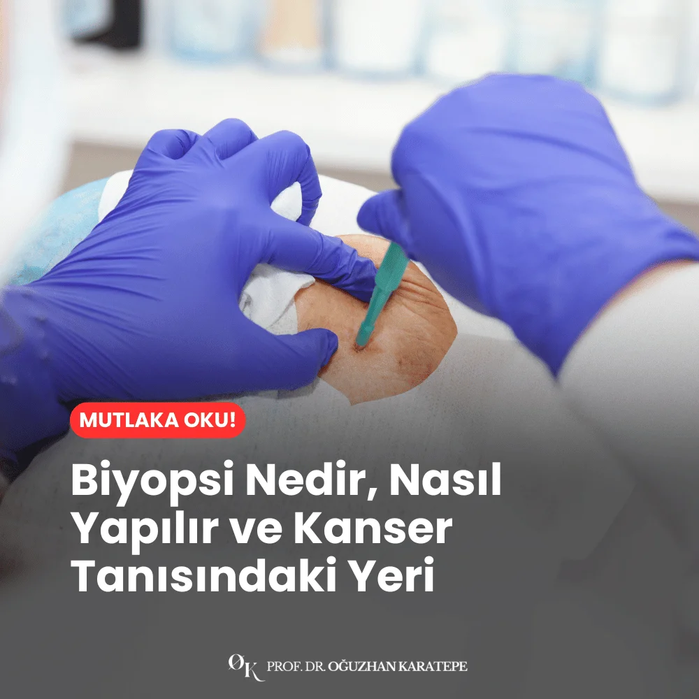 Biyopsi Nedir, Nasıl Yapılır ve Kanser Tanısındaki Yeri nedir