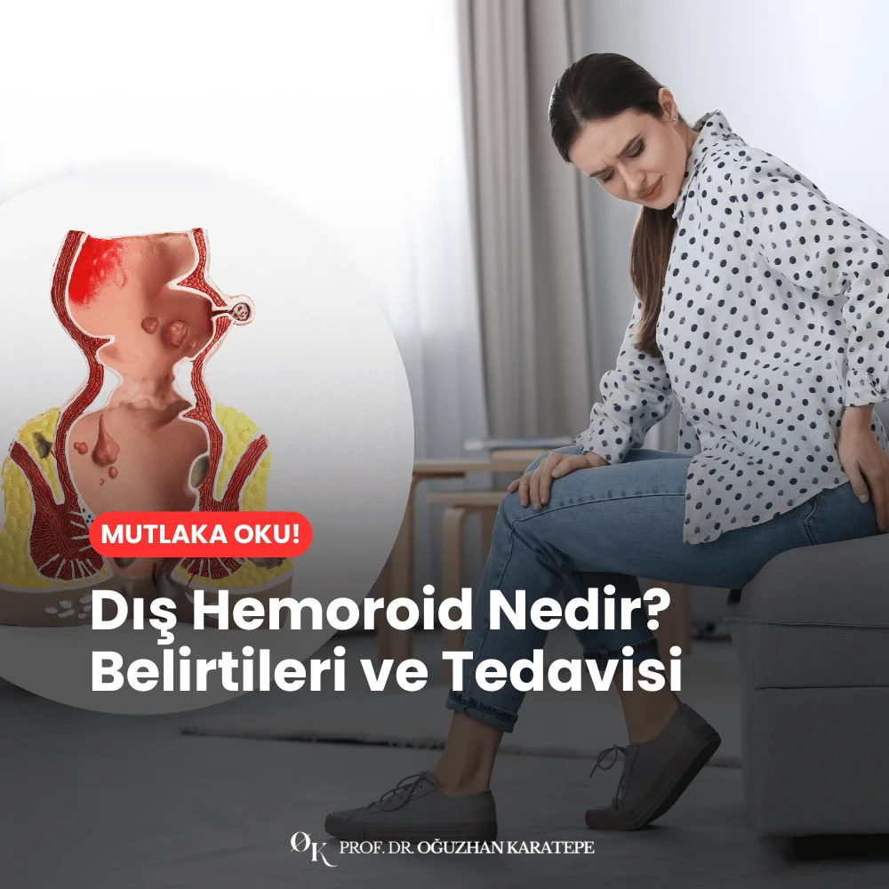 Dış Hemoroid Nedir? Belirtileri ve Tedavisi nedir