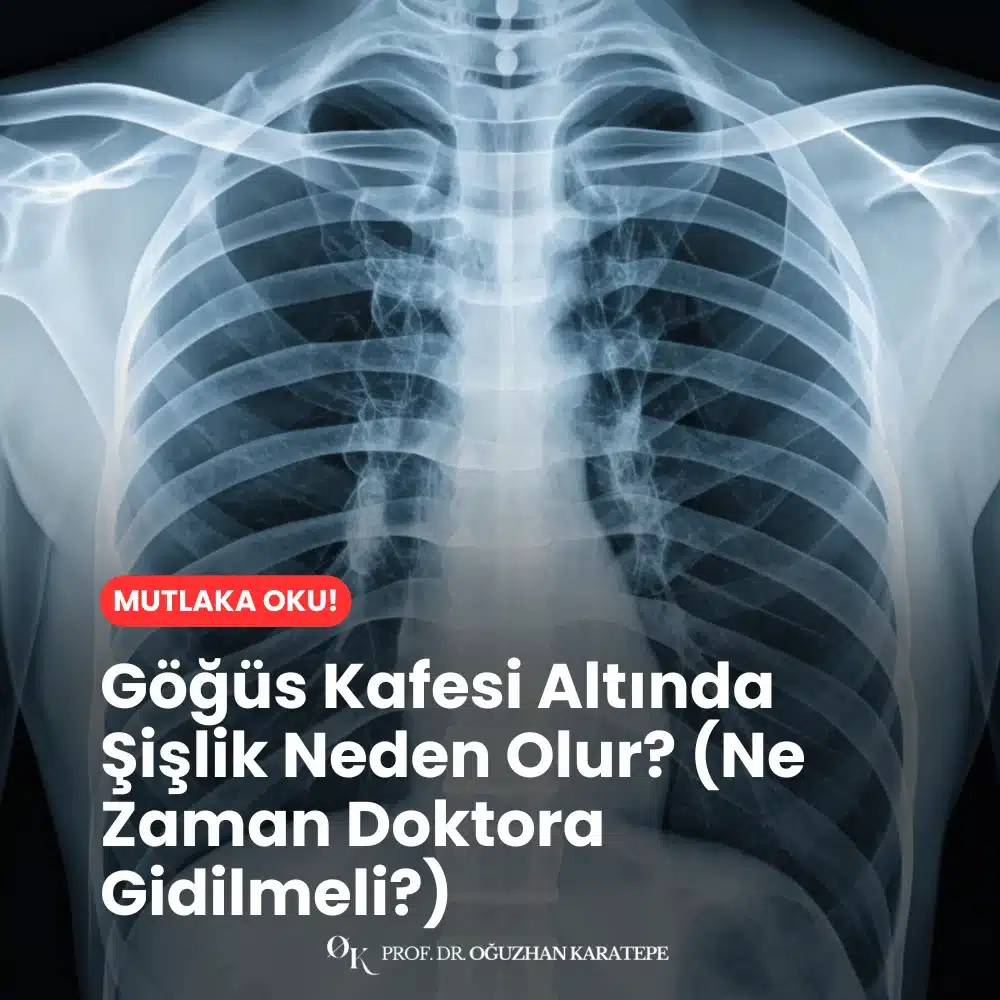 Göğüs Kafesi Altında Şişlik Neden Olur? (Ne Zaman Doktora Gidilmeli?) Nedir