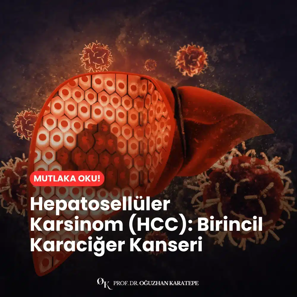Hepatosellüler Karsinom (HCC) Birincil Karaciğer Kanseri Nedir
