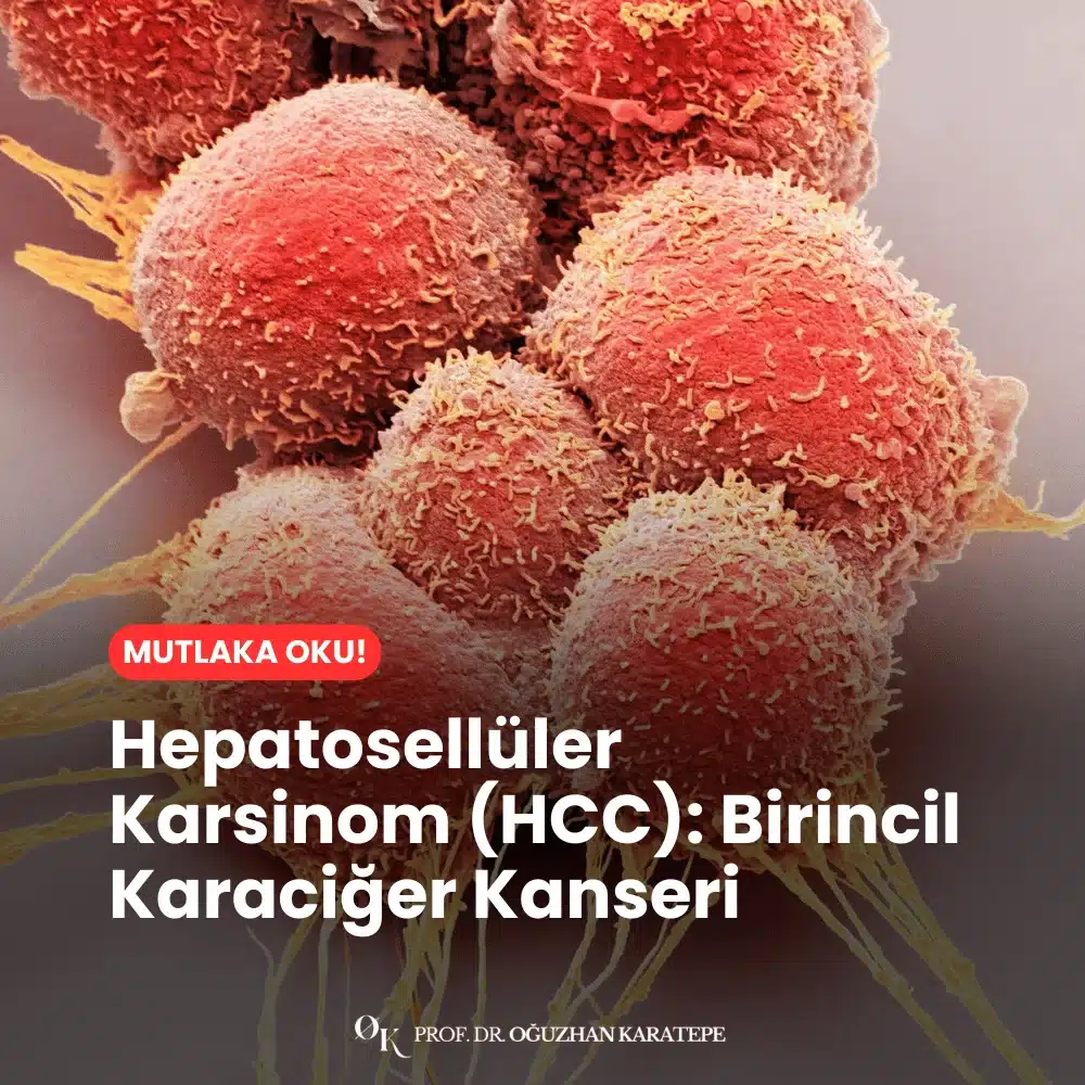 Hepatosellüler Karsinom (HCC) Birincil Karaciğer Kanseri