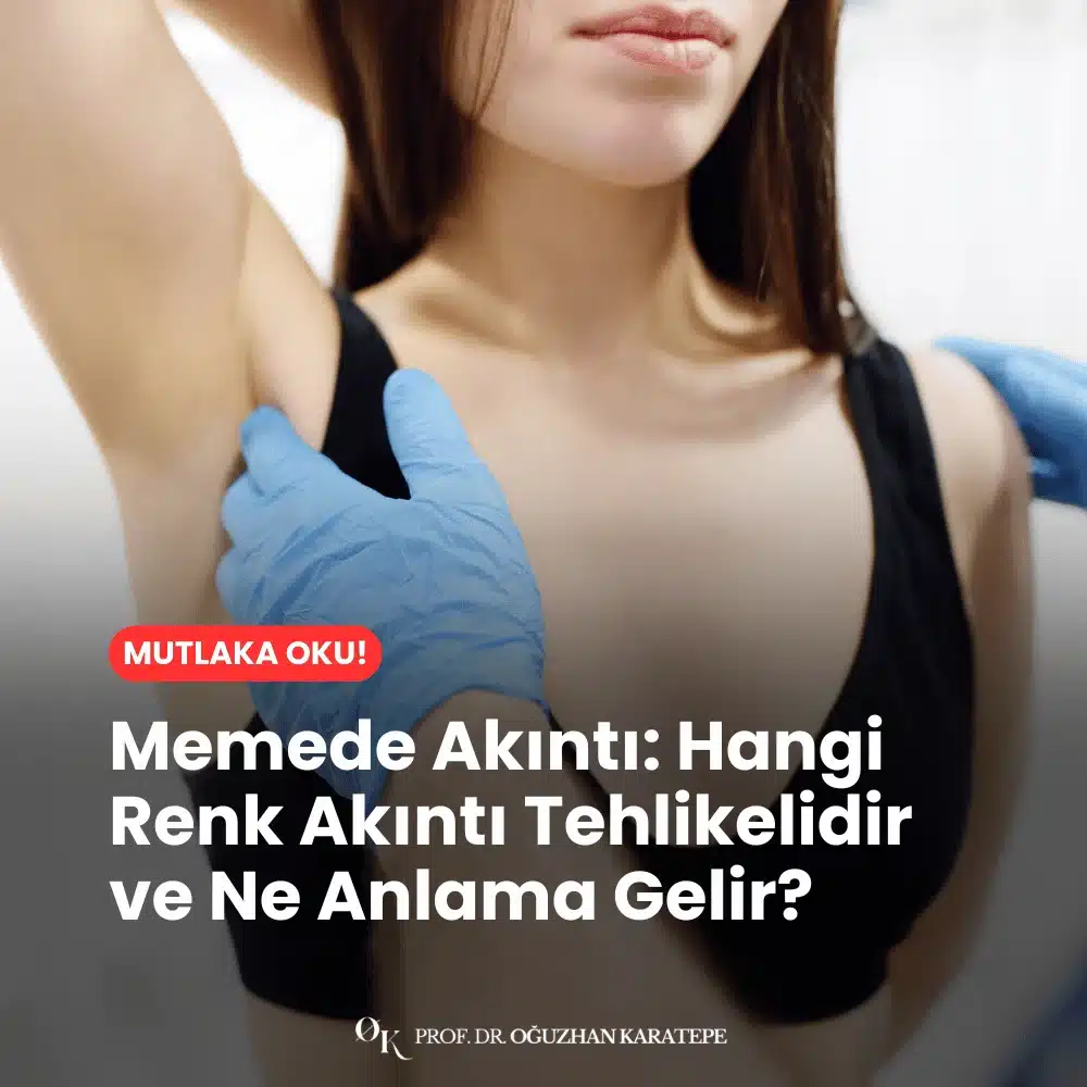 Memede Akıntı Hangi Renk Akıntı Tehlikelidir ve Ne Anlama Gelir?