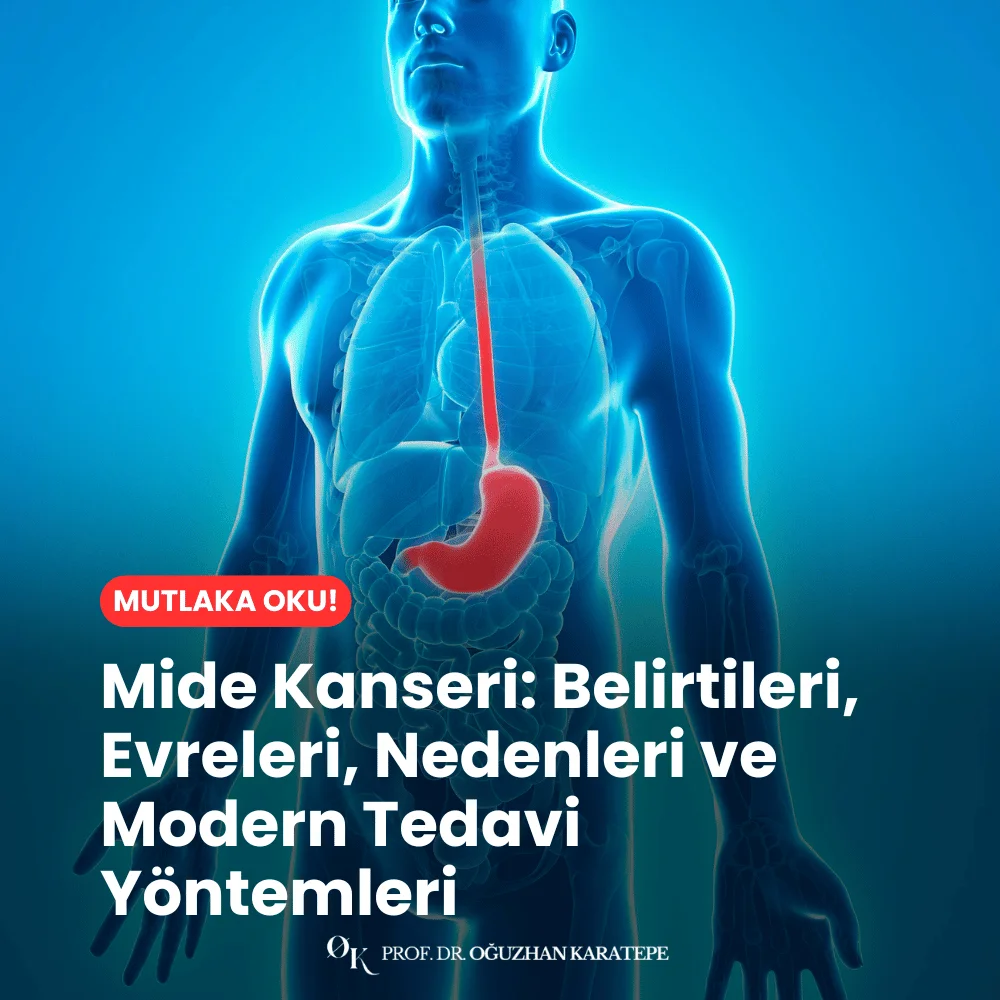 Mide Kanseri Belirtileri, Evreleri, Nedenleri ve Modern Tedavi Yöntemleri