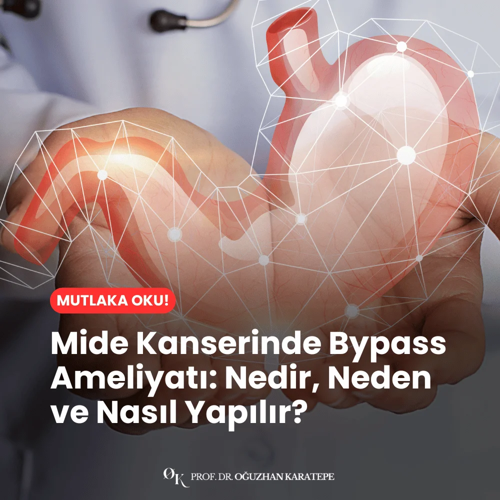 Mide Kanserinde Bypass Ameliyatı Nedir, Neden ve Nasıl Yapılır