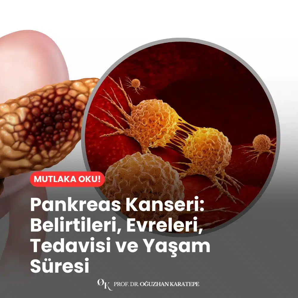 Pankreas Kanseri Belirtileri, Evreleri, Tedavisi ve Yaşam Süresi Ne