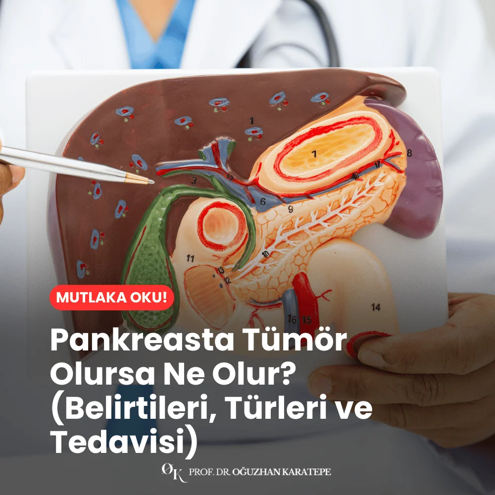 Pankreasta Tümör Olursa Ne Olur? (Belirtileri, Türleri ve Tedavisi) Ne
