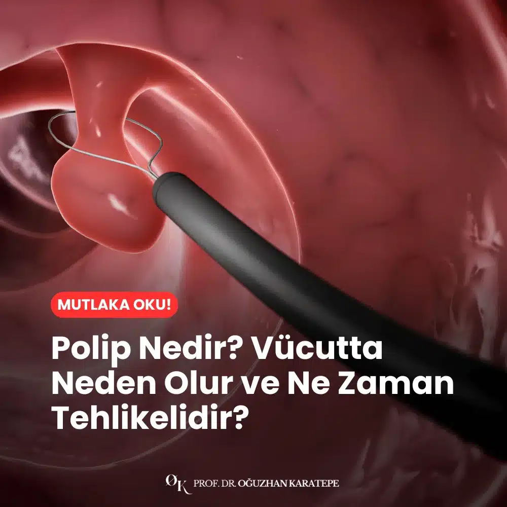 Polip Nedir? Vücutta Neden Olur ve Ne Zaman Tehlikelidir?