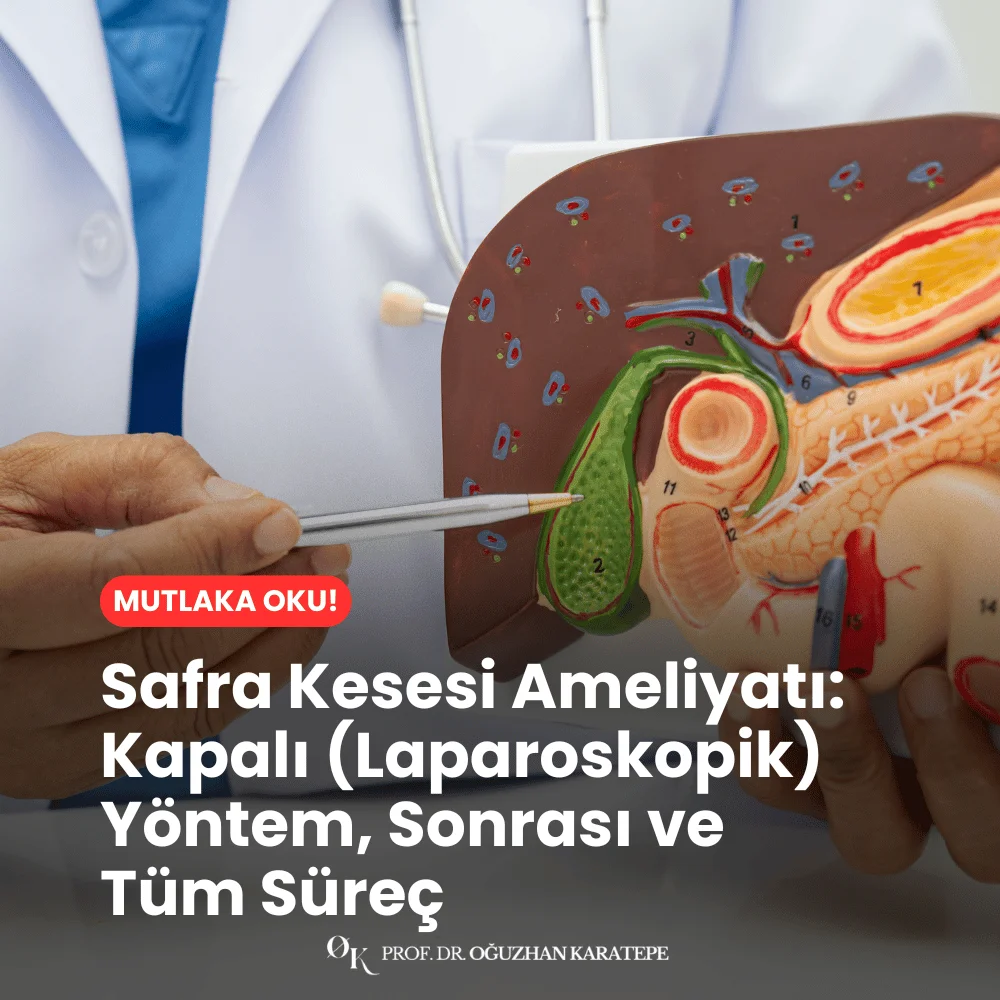 Safra Kesesi Ameliyatı Kapalı (Laparoskopik) Yöntem, Sonrası ve Tüm Süreç nedir