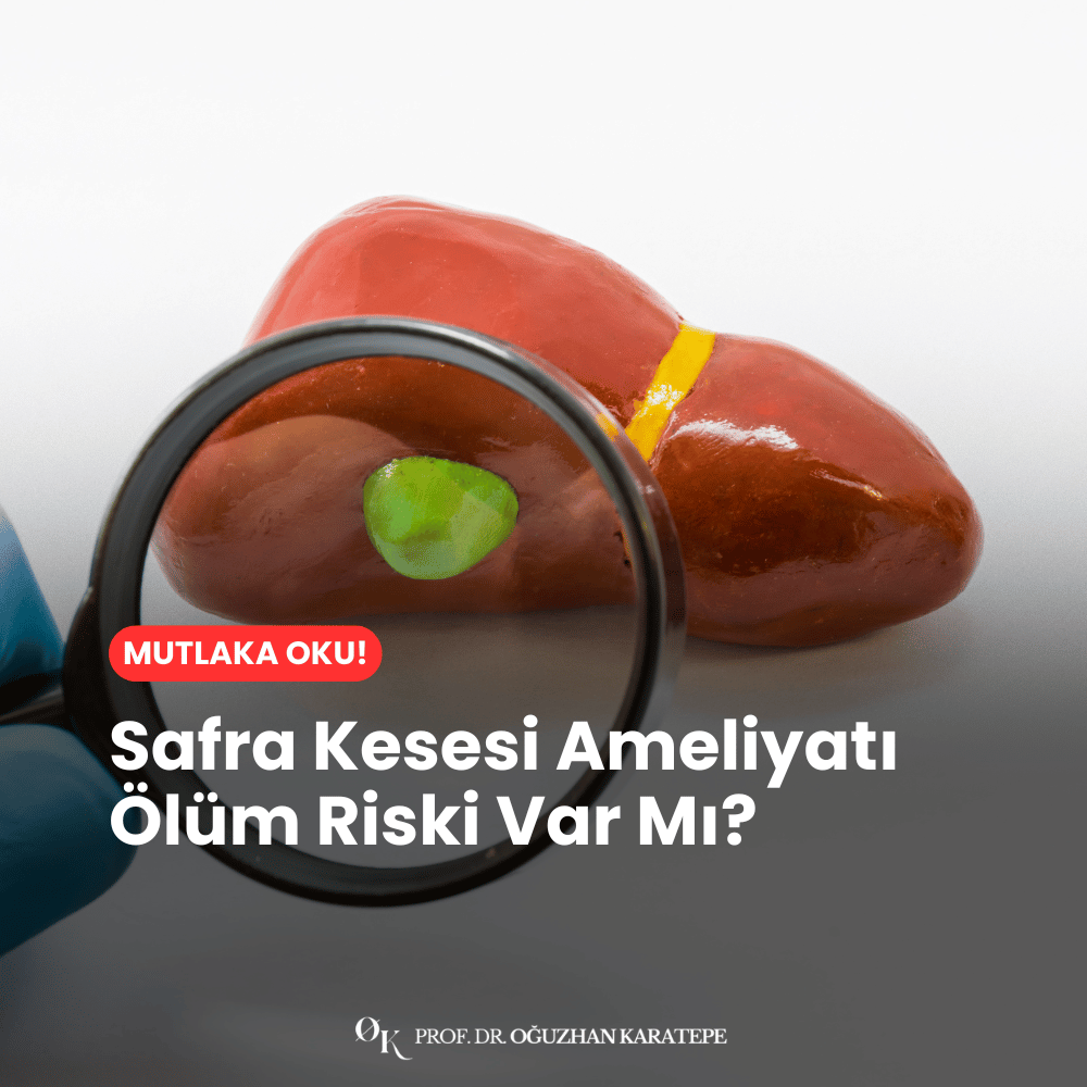 Safra Kesesi Ameliyatı Ölüm Riski Var Mı