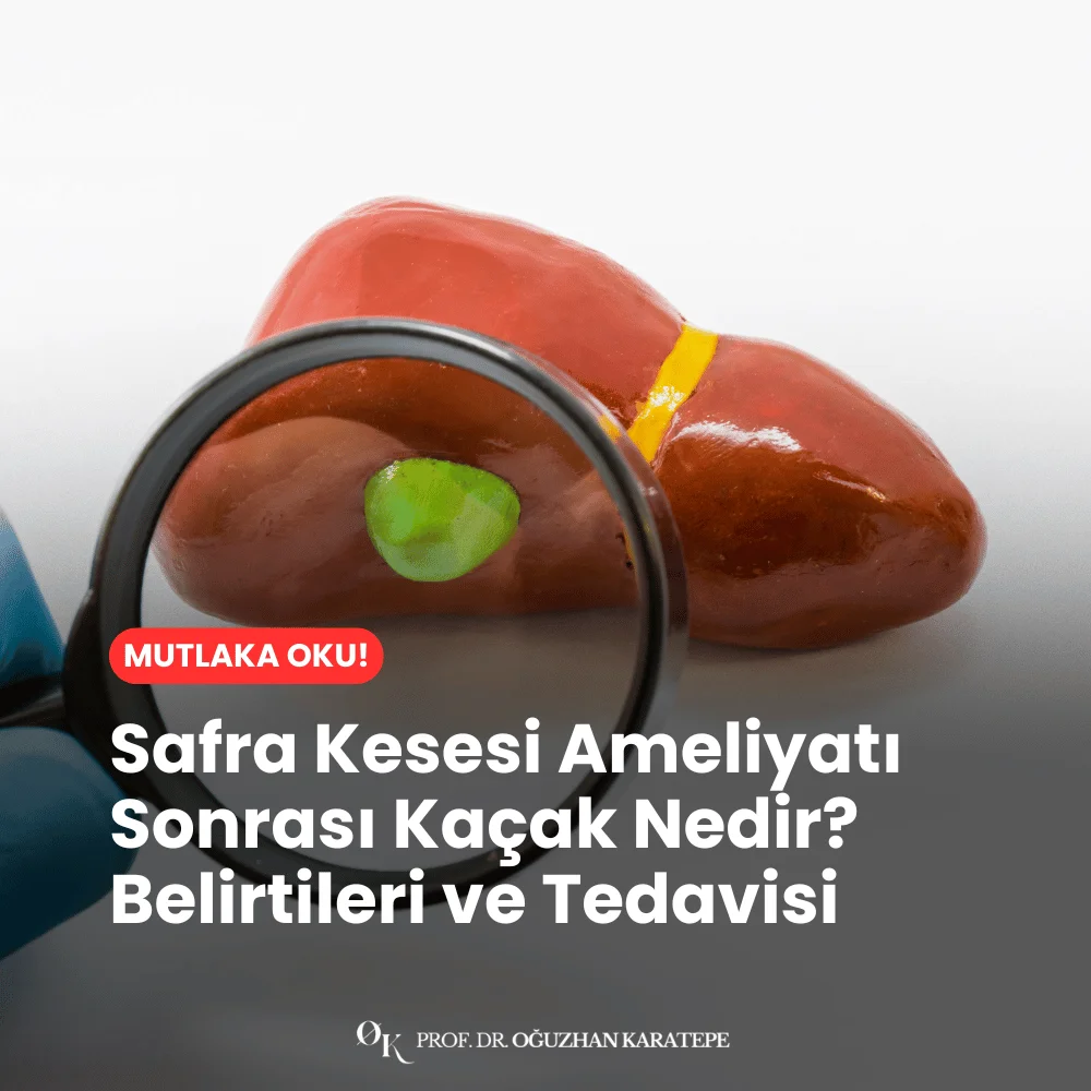 Safra Kesesi Ameliyatı Sonrası Kaçak Nedir? Belirtileri ve Tedavisi Nedir