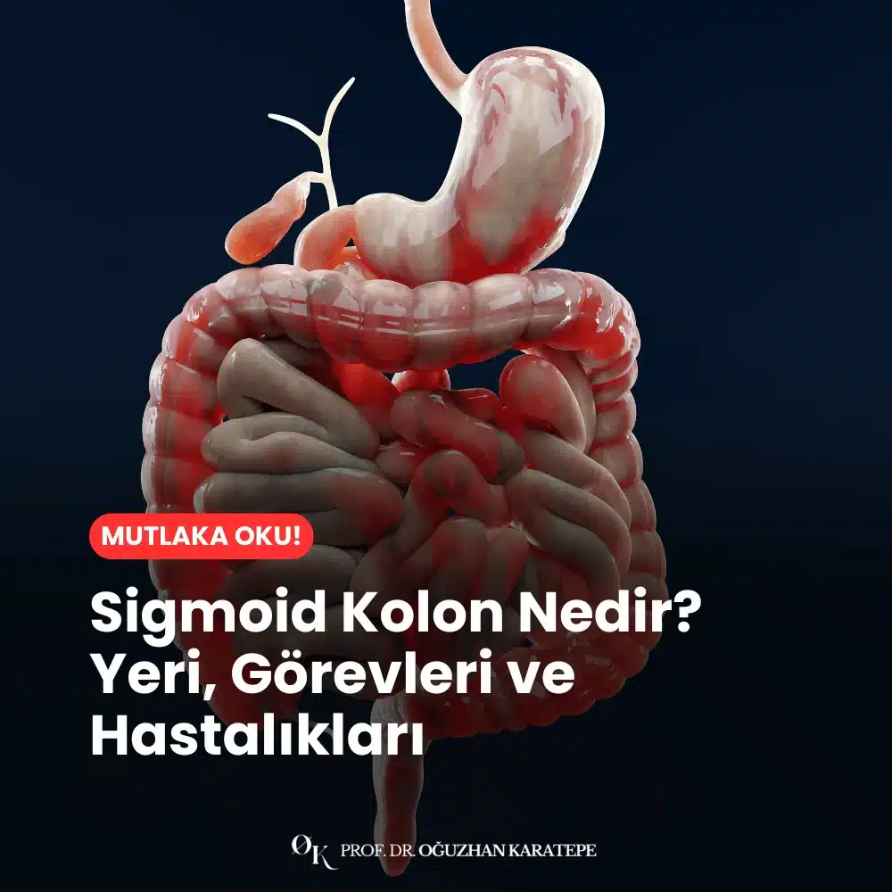 Sigmoid Kolon Nedir? Yeri, Görevleri ve Hastalıkları Ne
