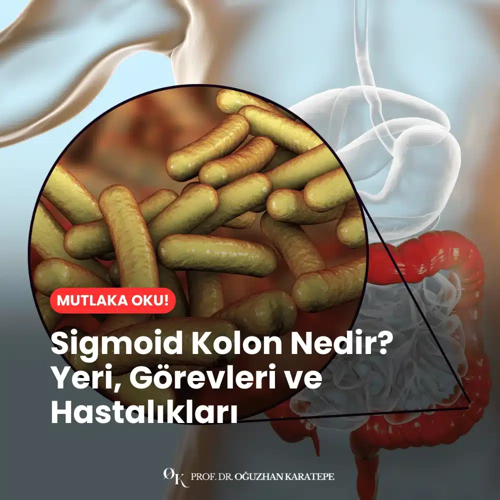 Sigmoid Kolon Nedir? Yeri, Görevleri ve Hastalıkları