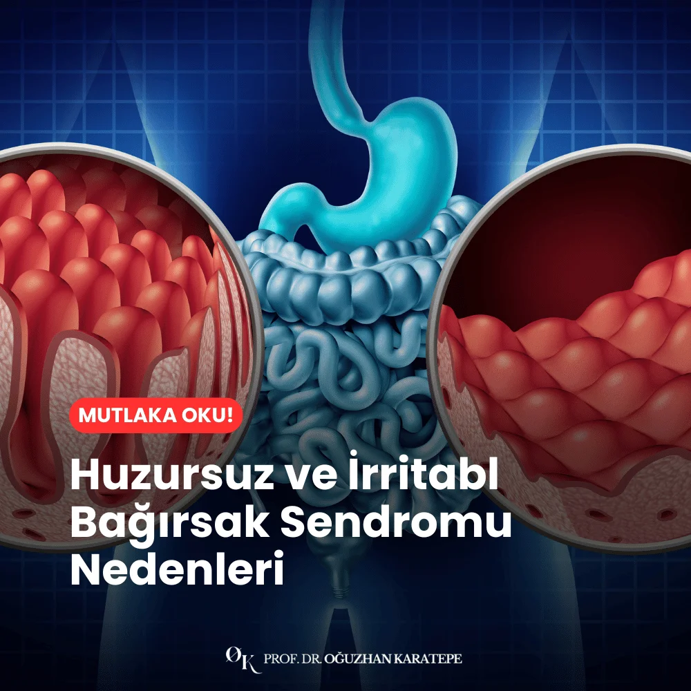 huzursuz bağırsak sendromu, irritabl bağırsak sendromu, huzursuz bağırsak sendromu belirtileri, huzursuz bağırsak sendromu tedavisi