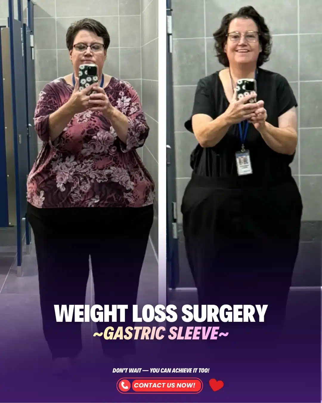 Bariatric Surgery Turkey Before After