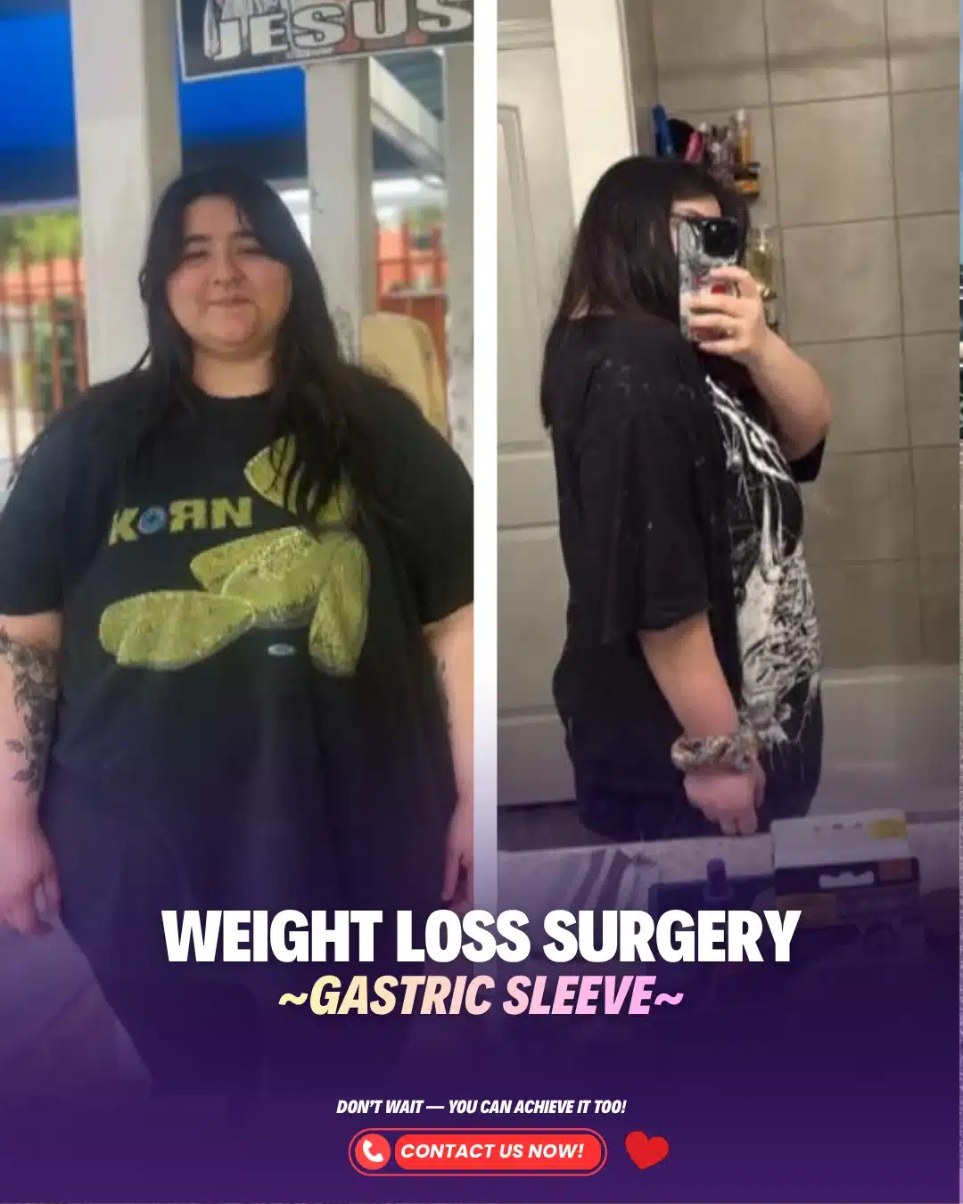 Best Bariatric Surgeon Turkey