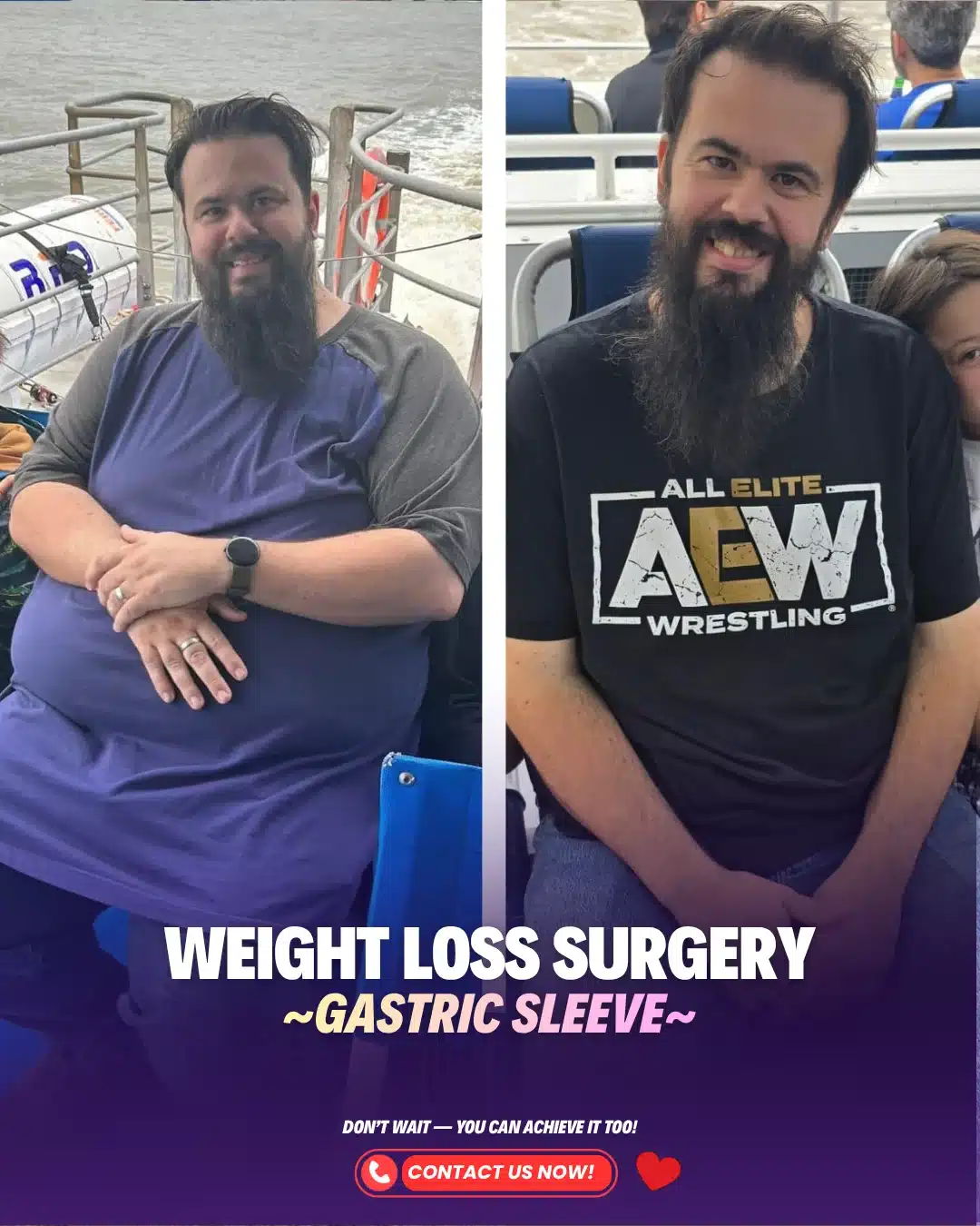 Best Bariatric Surgery Turkey