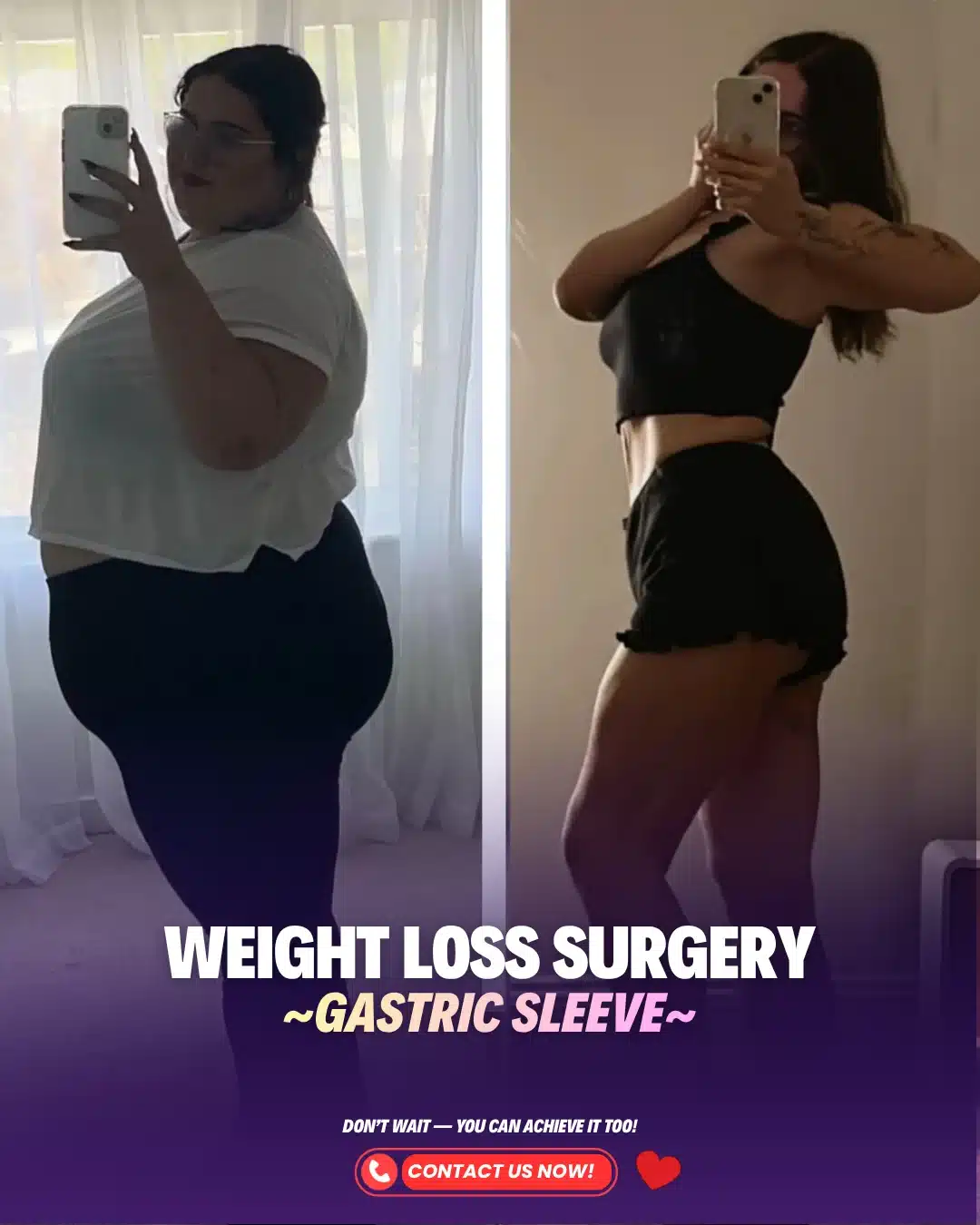 Best Bariatric Surgeon Turkey