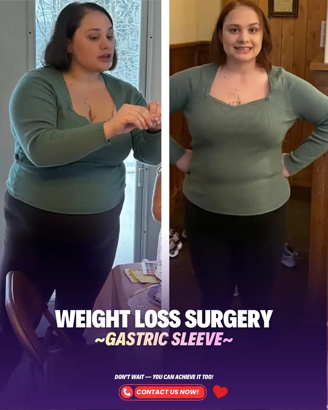 Best Bariatric Surgery Turkey