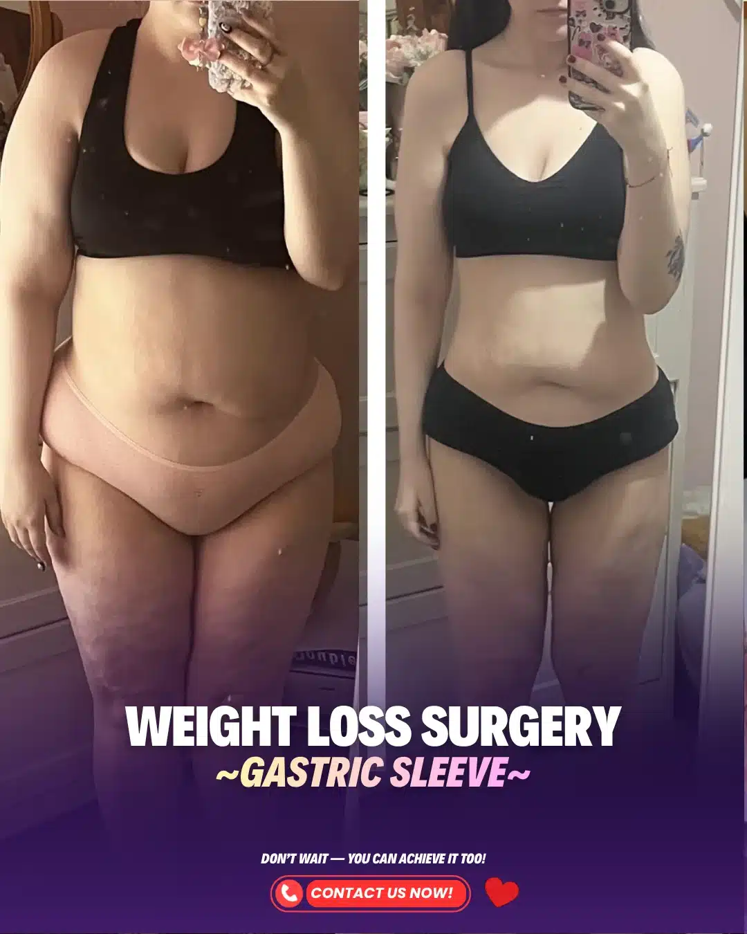 Best Bariatric Surgeon Turkey