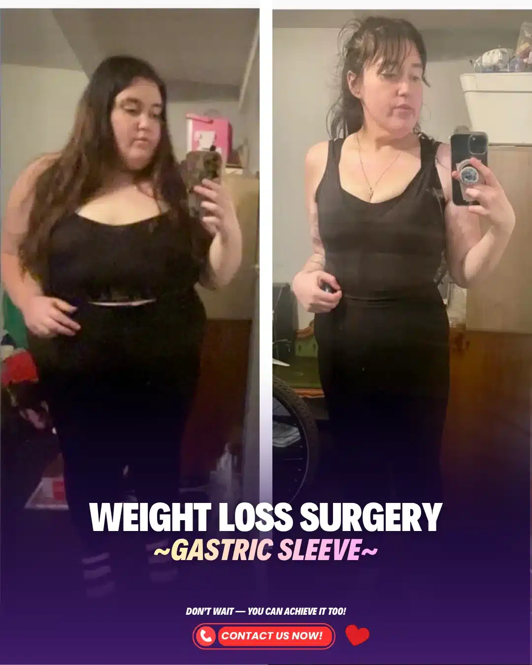 Best Turkey Weight Loss Bariatric Gastric Sleeve