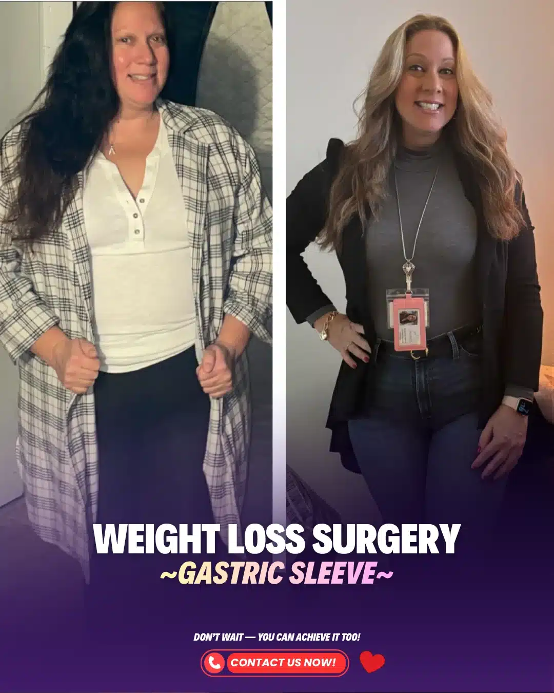 Best Weight Loss Surgeon Turkey