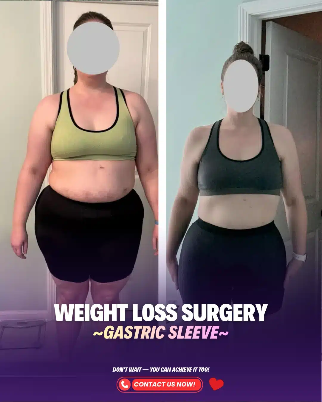 Best Bariatric Surgery Turkey