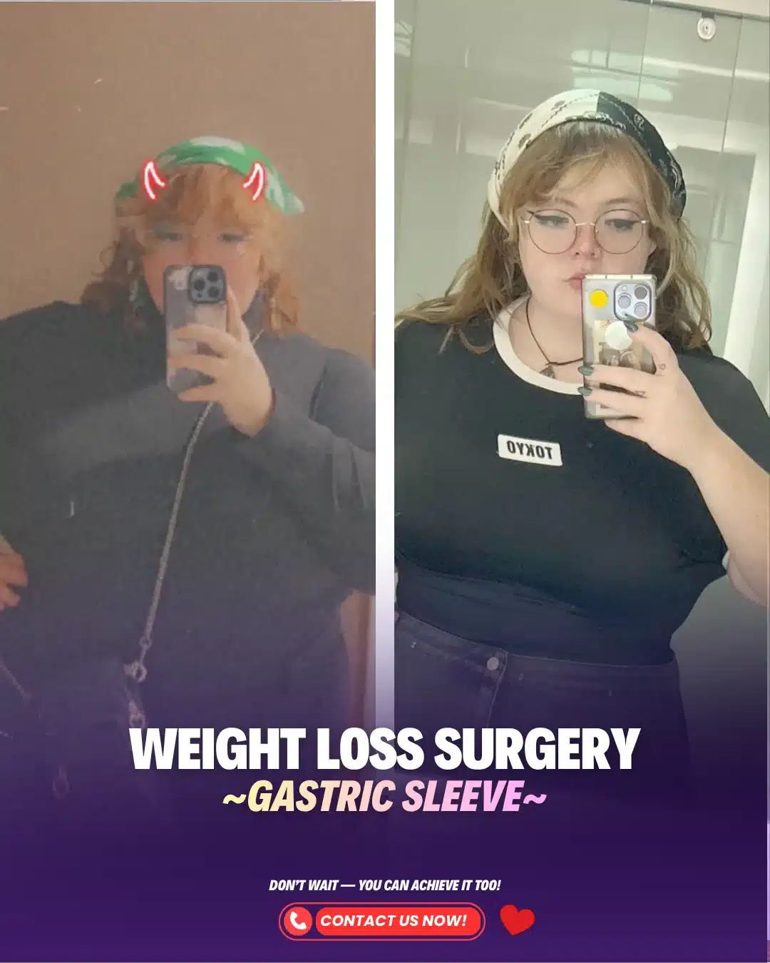 Gastric Sleeve Surgeon Turkey