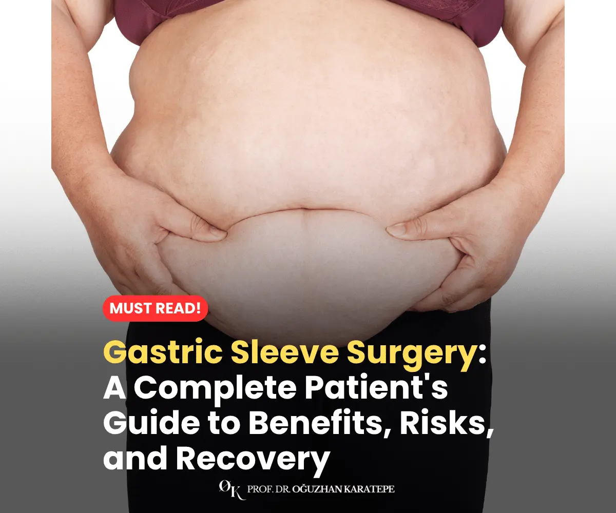 Gastric Sleeve Surgery