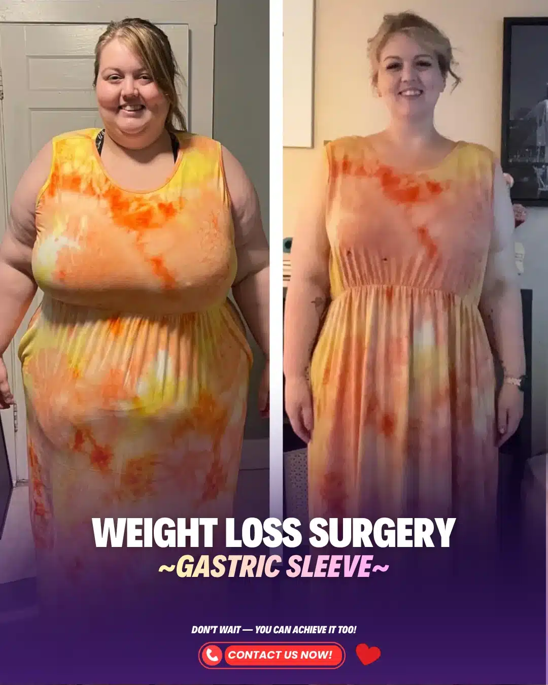 Best Bariatric Surgeon Turkey