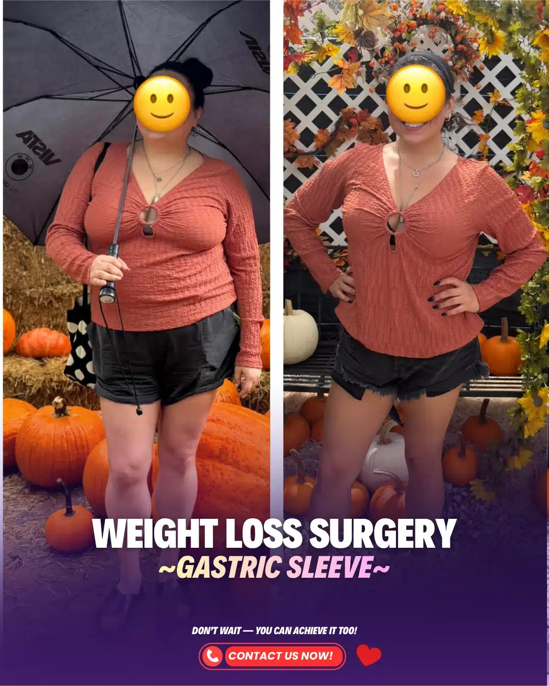 Best Bariatric Surgery Turkey