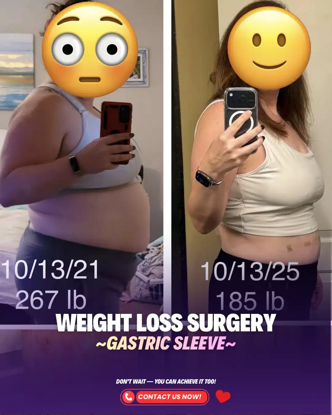 Best Bariatric Surgeon Turkey