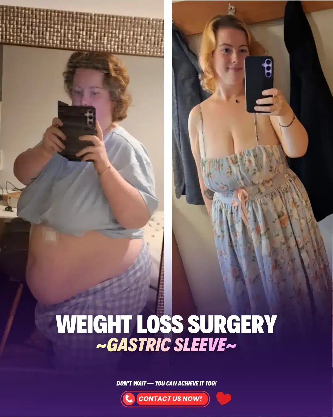 Best Bariatric Surgeon Turkey