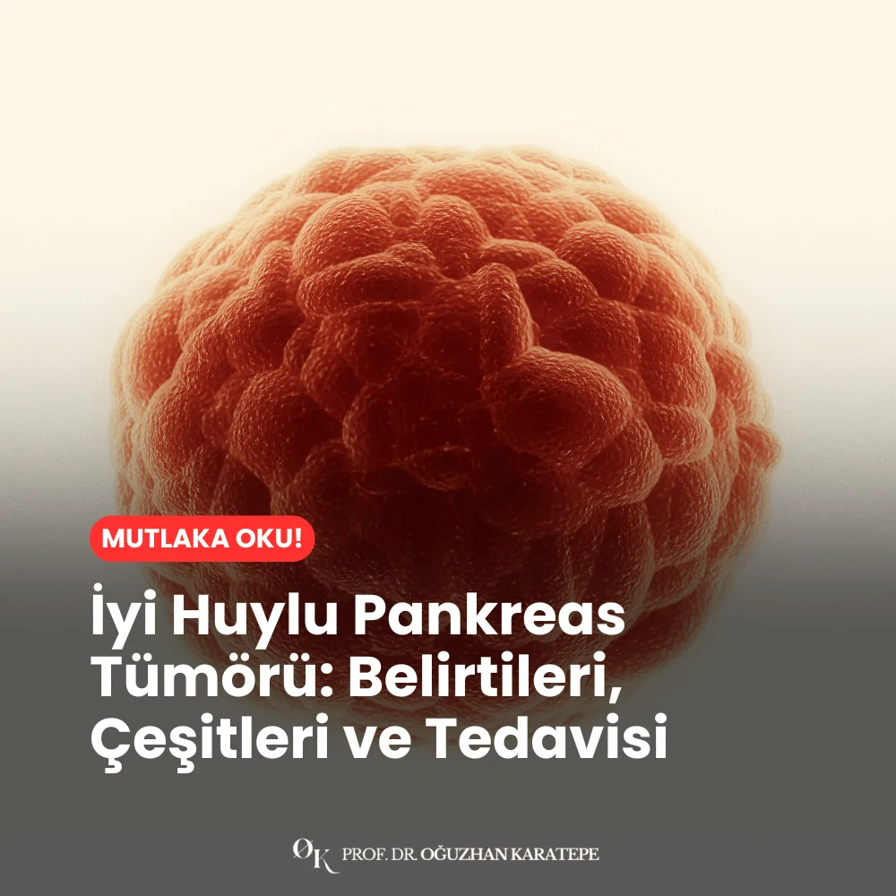 İyi Huylu Pankreas Tümörü Belirtileri, Çeşitleri ve Tedavisi