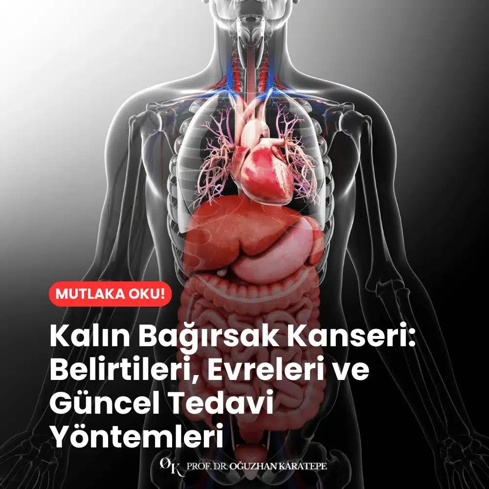 Kalın Bağırsak Kanseri Belirtileri, Evreleri ve Güncel Tedavi Yöntemleri Nedir Kalın Bağırsak Kanseri Belirtileri, Evreleri ve Güncel Tedavi Yöntemleri Nedir