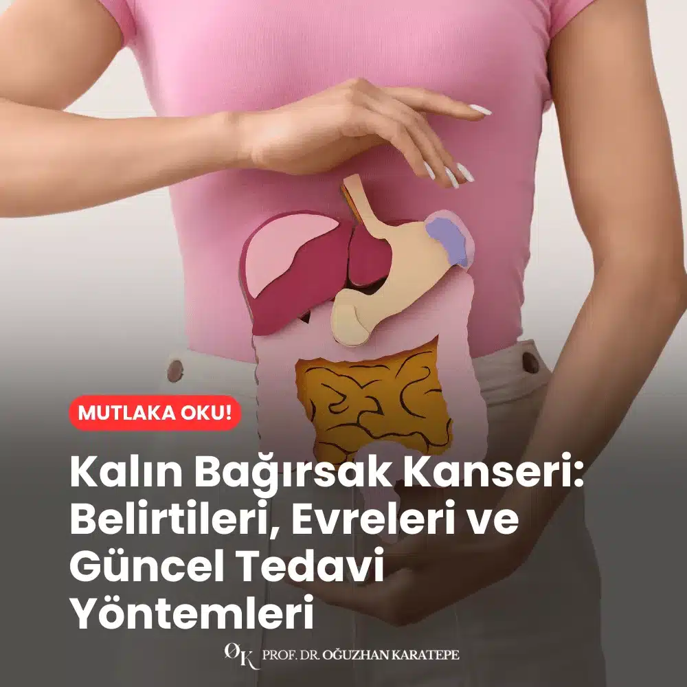 Kalın Bağırsak Kanseri Belirtileri, Evreleri ve Güncel Tedavi Yöntemleri