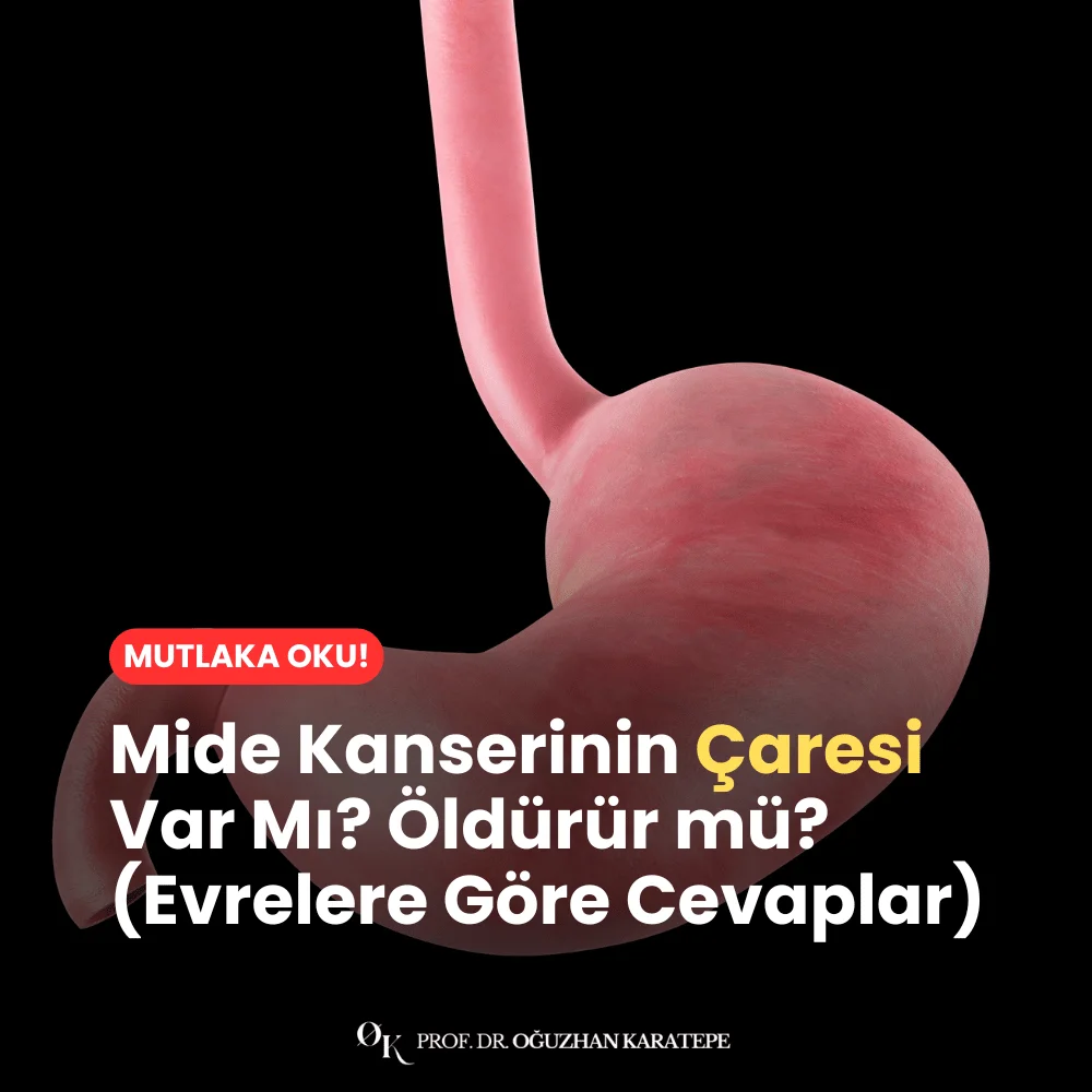 Mide Kanserinin Çaresi Var Mı? Öldürür mü? (Evrelere Göre Cevaplar)