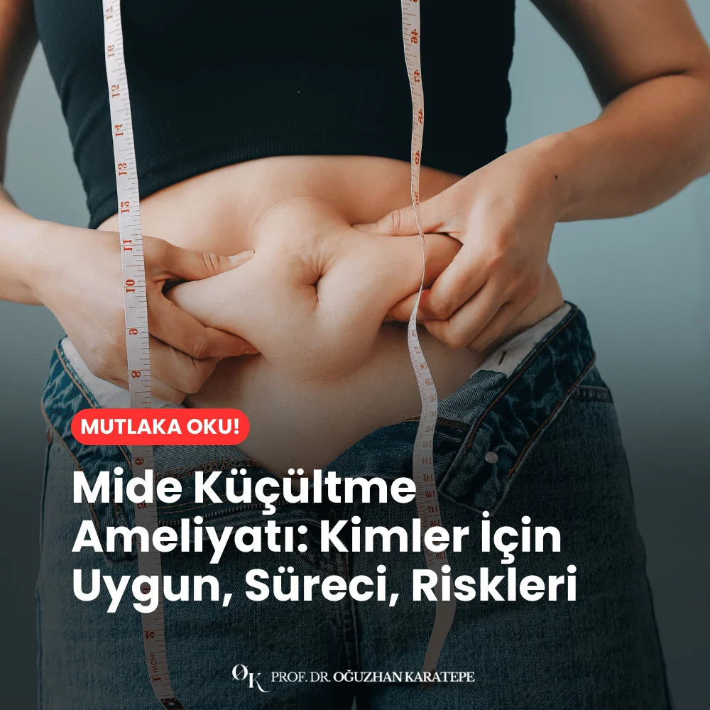 Mide Küçültme Ameliyatı Kimler İçin Uygun, Süreci, Riskleri Nedir